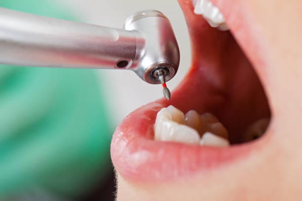 Best Emergency Treatment for Toothache in Wallace, ID